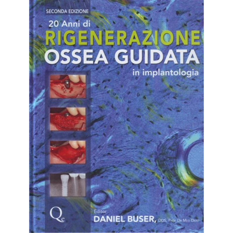 20 anni di rigenerazione ossea guidata in implantologia - Seconda edizione + 2 grandi classici in omaggio